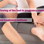 Flowing of the foot in pregnancy causes, and treatment methods
