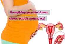 Everything you don't know about ectopic pregnancy!