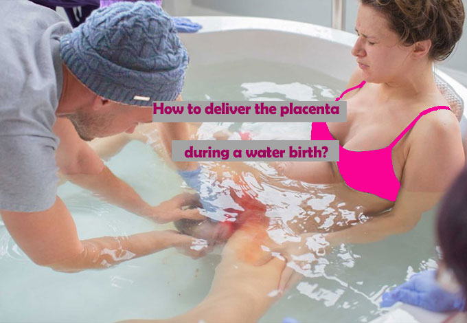 How to deliver the placenta during a water birth?