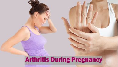 Arthritis in pregnancy