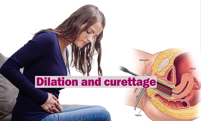 Dilation and curettage