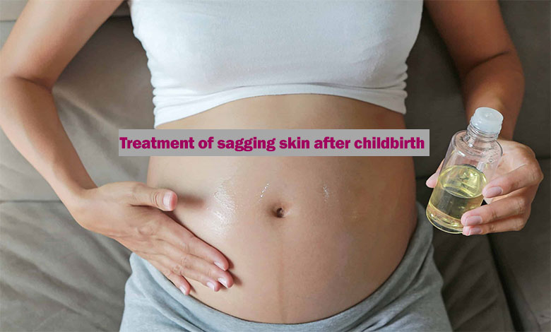 Treatment of sagging skin after childbirth