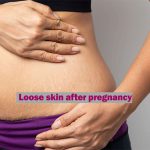 Loose skin after pregnancy