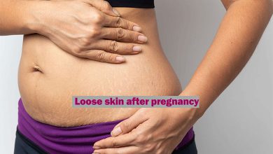 Loose skin after pregnancy