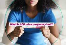 What is hCG urine pregnancy test?