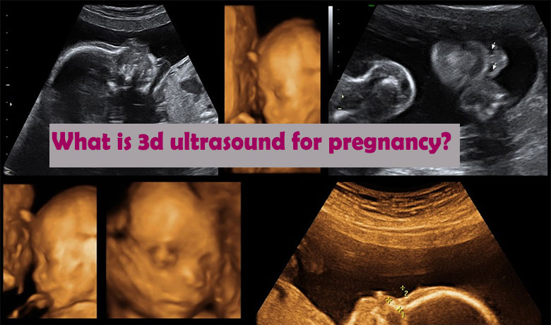 what is 3d ultrasound for pregnancy?